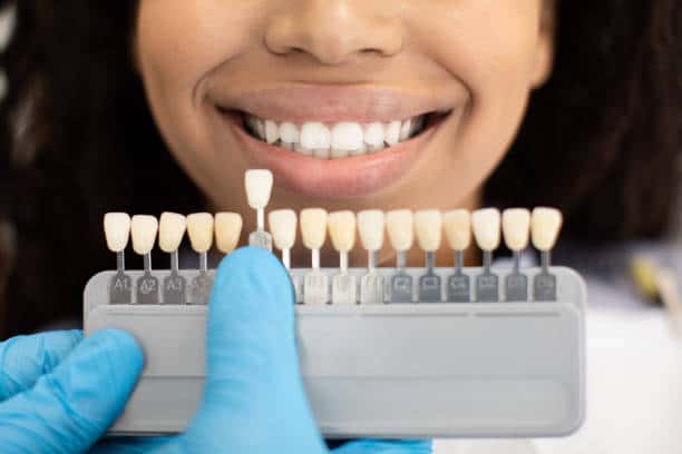 Laser Teeth Whitening: Exploring the Longevity of Your Brighter Smile St Albans