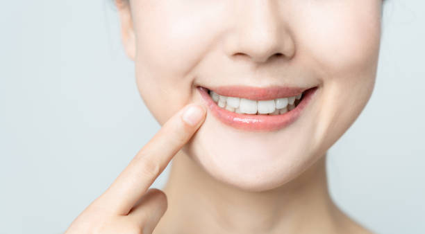 Comparing the Pain Factor: Laser Teeth Whitening vs. Zoom Teeth Whitening St Albans