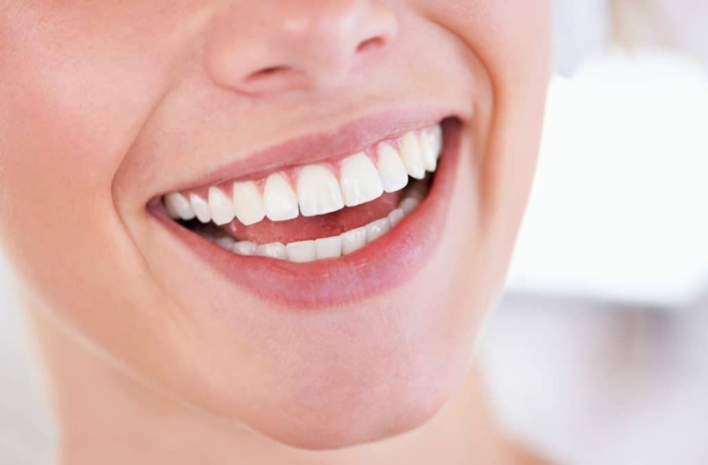 Teeth Whitening West Drayton St Albans