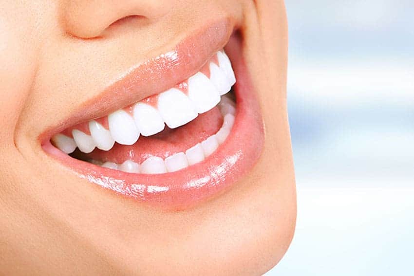 Teeth Whitening Abingdon St Albans